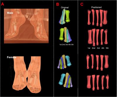 Study of Sexual Dimorphism in Metatarsal Bones: Geometric and Inertial Analysis of the Three-Dimensional Reconstructed Models